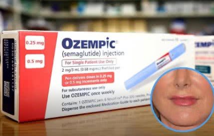 Celebridades como Sharon Osbourne e Rebel Wilson podem ser exemplos da alteração estética provocada pelo uso do Ozempic. - Divulgação