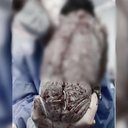 O nascimento de Bernardo gerou curiosidade ao mostrar o DIU da mãe colado ao seu corpo logo após o parto, viralizando nas redes sociais. - Divulgação