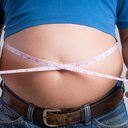 A obesidade no Rio Grande do Norte é um reflexo de fatores socioeconômicos, com a população vulnerável enfrentando altos índices de obesidade. - Divulgação