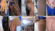 Celas de castigo/isolamento e triagem com internos machucados, lesionados e com diversos problemas de saúde - MNPCT