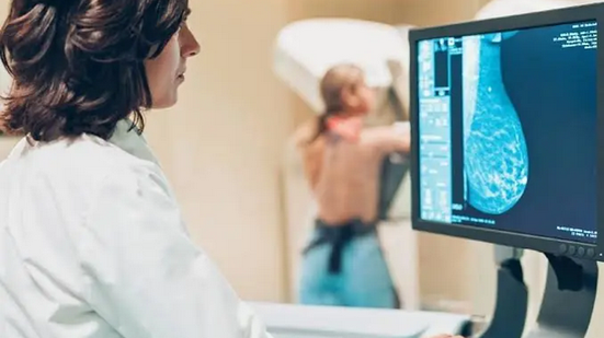 ANS amplia cobertura de mamografia para mulheres a partir de 40 anos - Reprodução