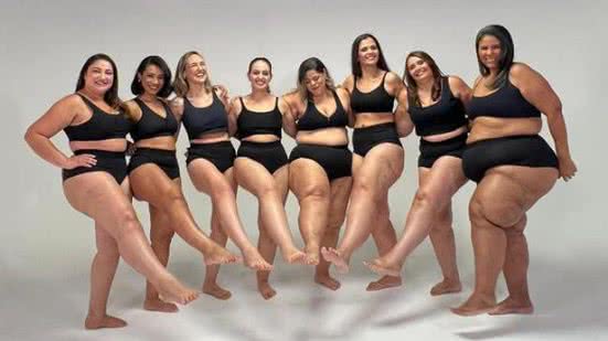 A Lipedema é uma condição crônica que não é tão conhecida, mas afeta centenas de mulheres - Divulgação