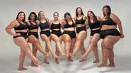 A Lipedema é uma condição crônica que não é tão conhecida, mas afeta centenas de mulheres - Divulgação