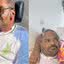 Arlindo Cruz, ícone do samba, continua sua batalha pela saúde após complicações médicas. - Divulgação