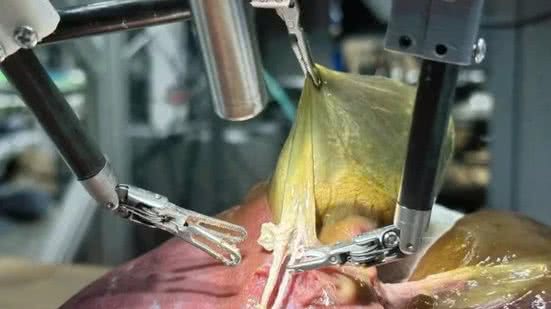 Foto: Juo-Tung Chen / Johns Hopkins University.