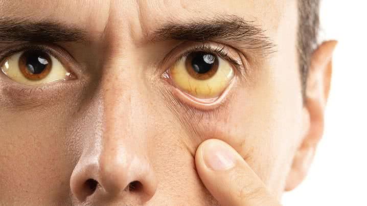Brasil reduz mortalidade por hepatites com avanço na vacinação - Reprodução