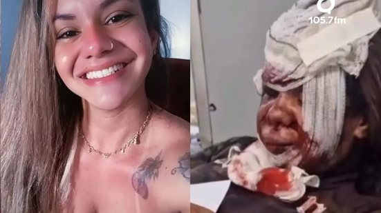 Juliana Garcia, vítima da agressão, conquistou 430 mil seguidores - Reprodução