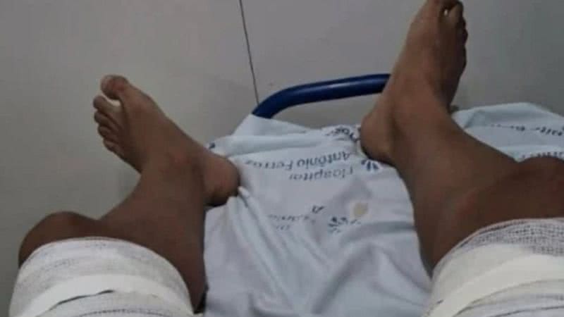 Após audiência de custódia, a agressora foi liberada, mas responderá judicialmente por lesão corporal em decorrência do crime. - Divulgação