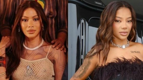 A harmonização facial se torna tema de debate após a aparição de Anitta, levantando questões sobre identidade e originalidade. - Divulgação