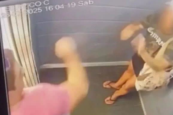Vítima de agressão no elevador passará por cirurgia de reconstrução facial - Reprodução