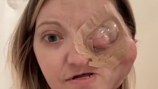 Nicole faleceu aos 33 anos, mas sua história de resiliência e amor continua a inspirar - Reprodução