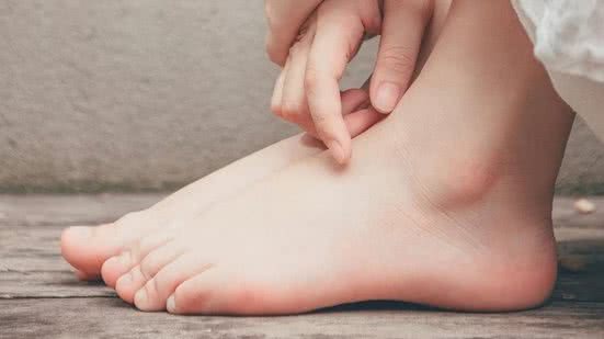 Como preparar um creme caseiro para evitar ressecamento nos pés - Reprodução