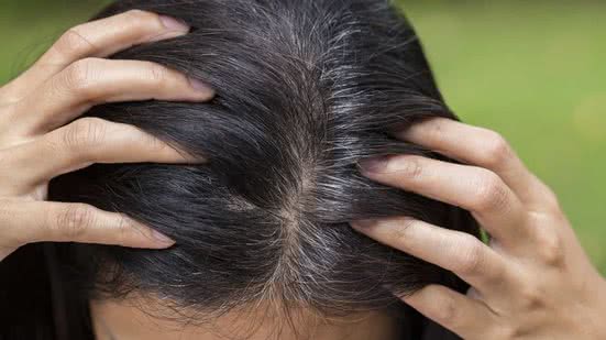 Cabelos brancos causados por stress podem ser revertidos, diz estudo - Reprodução