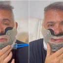 A cirurgia bucomaxilofacial visa melhorar sua qualidade de vida - Reprodução