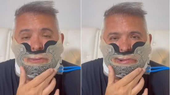 A cirurgia bucomaxilofacial visa melhorar sua qualidade de vida - Reprodução