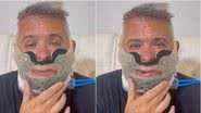 A cirurgia bucomaxilofacial visa melhorar sua qualidade de vida - Reprodução