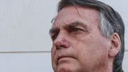 Imagem De alta médica, Bolsonaro tem laudo que indica câncer