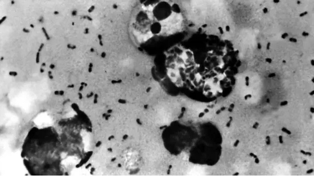 Doença é causada por bactéria Yersinia pestis.